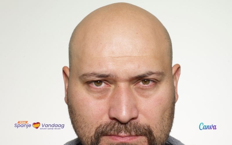 Waar zijn meer kale mannen te vinden: Spanje, Nederland of België?