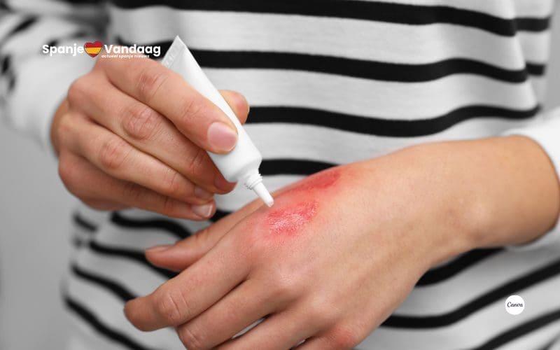 Nieuwe 20 miljoen euro kostende gentherapie voor ‘vlinderkinderen’ geeft hoop in Spanje