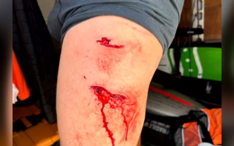 Wel of geen gewonde zwemmer na aanval haai bij Fuerteventura (UPDATE)